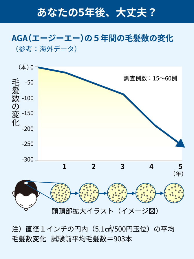 AGA（エージーエー）の毛髪数の変化