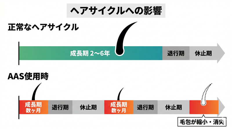 正常なヘアサイクル（成長期2〜6年）とアナボリックステロイド使用時（成長期数ヶ月）の比較タイムライン